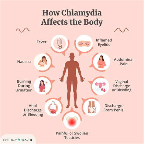 symptoms for chlamydia are similar to the symptoms of what